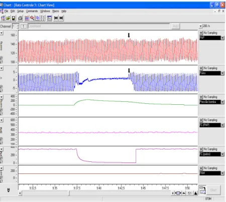 Figura  6 –  Representação  da  janela  de  visualização  do  software  Chart®  durante  um  experimento  de  pletismografia  e  de  canulação  simultânea