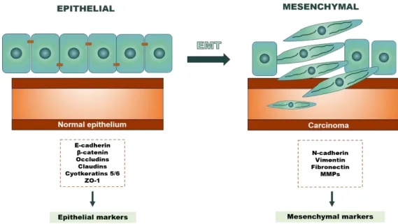 Figure 4. Cellular features alterations associated with EMT biological process. During EMT the  cells lose epithelial features and acquire mesenchymal features