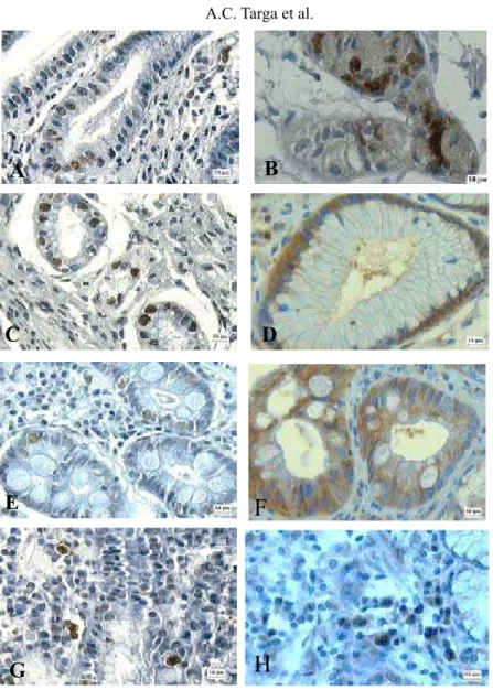 Figure 1. Sections of the different gastric tissues showing apoptotic cells after immunostaining by TUNEL (nuclei  stained brown) and by CPP32 antibody (cytoplasm stained brown), respectively