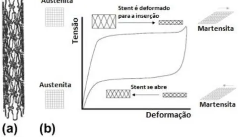 Figura 2.1.6 Esquema mostrando a transformação de fase envolvida no uso do  stent [9]