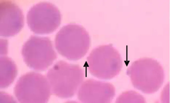 Figura 7- Eritrócitos infectados pelo Mycoplasma haemofelis (seta). 240X. 