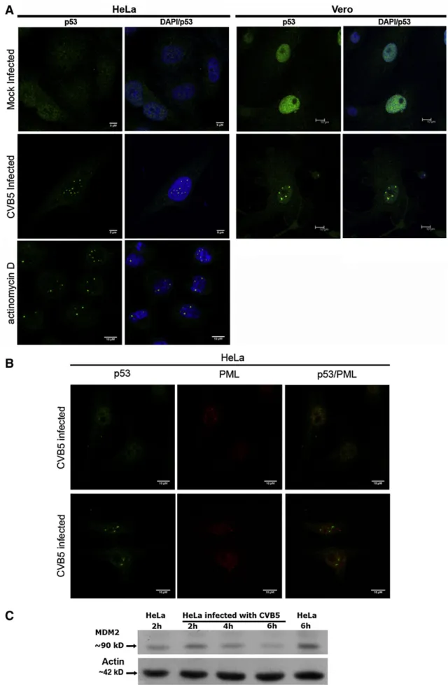 Fig. 2. CVB5 replication in HeLa cells causes p53 to aggregate in the nucleus: Mock- and CVB5-infected HeLa and Vero cells (MOI=10) were ﬁxed at 4 h post-infection and stained with antibody to p53 and PML by immunoﬂuorescence