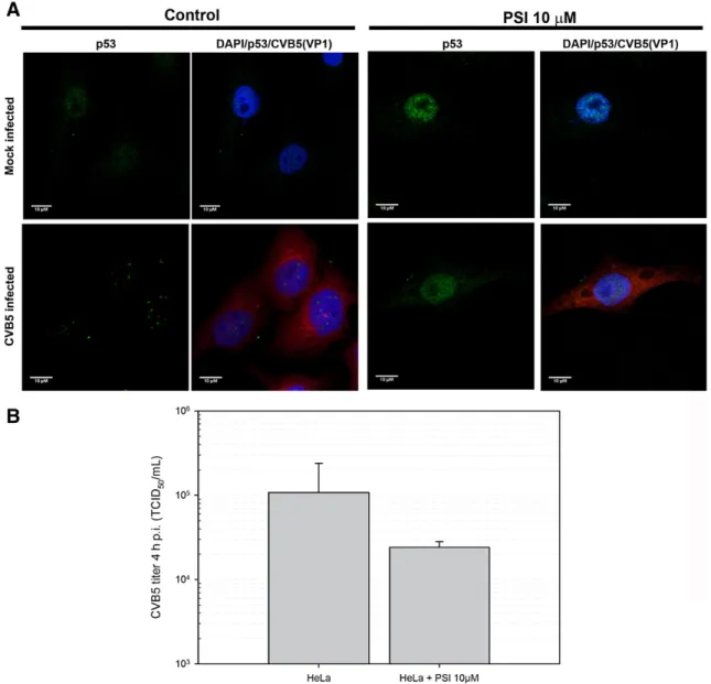 Fig. 4.Inhibition of proteasome abrogates p53 nuclear aggregation in CVB5-infected cells