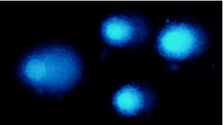 Figura  9:  Figura  de  “cometas”  mostrando  células  com  diferentes  níveis  de  dano  no  DNA,  os  quais  estão  evidenciados na cauda.