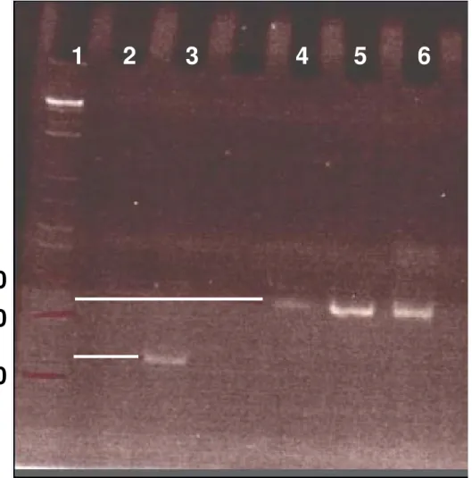 Figura 7: Eletroforese em gel de poliacrilamida dos produtos de PCR  mostrando a inserção de um fragmento de aproximadamente 150 pares  de bases, correspondente a seqüência codificante para LTx2, no sítio  múltiplo de clonagem do vetor pET11a