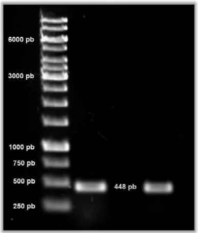 Figura  8  -  PCR  das  colônias  LTx5. O produto de amplificaç µL do Generuler™ 1 Kb DNA 