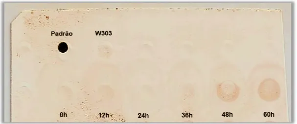 Figura  12  -  Dot  Blotting  d nitrocelulose foi sensibilizada c a vácuo, em um sistema Bio-Do em  solução  PBS-T  0,05%  con (Novagen) diluído 1:2000 e com 1:2000  (Zymed/Invitrogen)