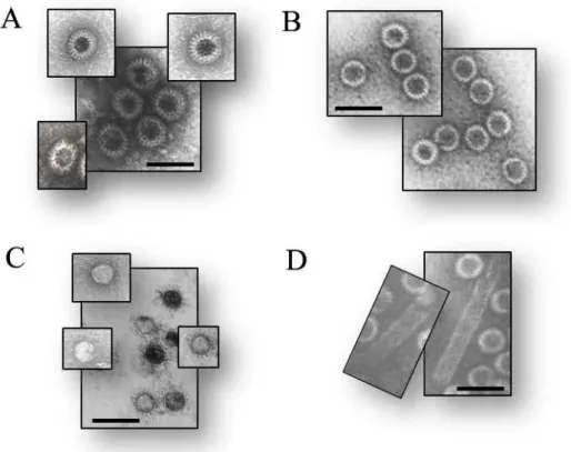 Figure 6. Electron micrograph of negatively stained RLPs (A), DLPs (B), single-layered vp2  particles (C) and vp6 tube-like structures (D) [81]