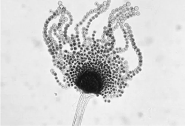 Fig.  1.4.  Asexual  reproductive  structure  (conidiophore)  of  Aspergillus  flavus
