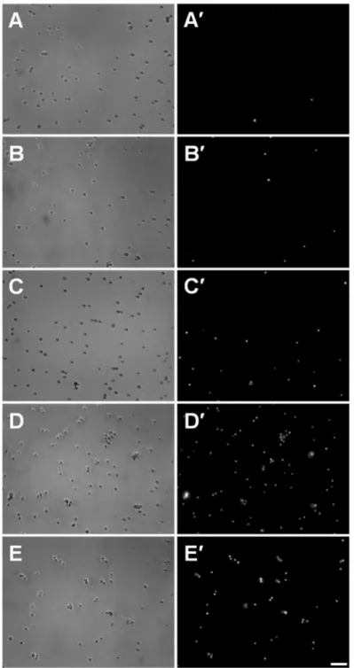 Fig.  2.3.  Membrane  integrity  assay.    Conidia  were  treated  with  100 mM  of  alkyltributylphosphonium  chlorides,  [P 4 4 4 n ]Cl  (n = 1,  4,  8  or  12),  during  one  hour  and  stained  with  propidium  iodide,  PI
