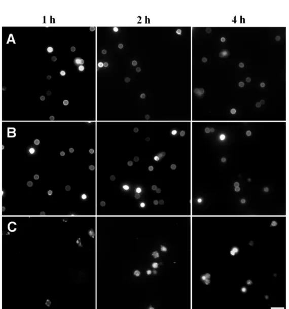 Fig.  2.4.    Cell  wall  damage  assay.    Conidia  were  treated  with  100 mM  of  alkyltributylphosphonium chlorides, [P 4 4 4 n ]Cl (n = 1 or 12), during one, two or four hours  and stained with Calcofluor White M2R (CFW)