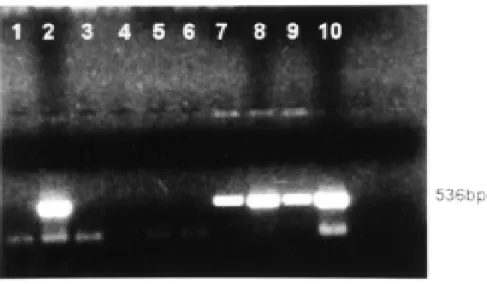 Fig. 4 -  DNA amplification by PCR with specific primers LO/UP in agarose gel electrophoresis stained with ethidium bromide