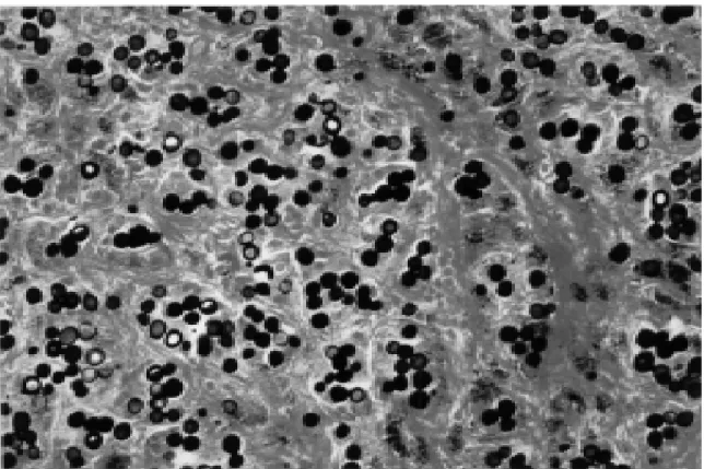 Fig. 4 - Histologic preparation stained with methenamine-silver of a mouse foot pad one and half year after inoculation