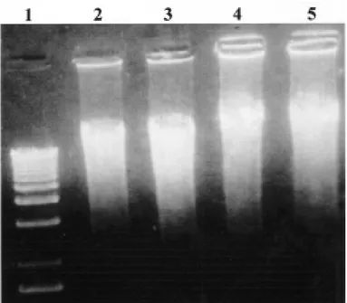 Fig. 1 – DNA isolated from individual B. tenagophila  snails susceptible and non-susceptible to schistosome infection was analysed by agarose 2% gel electrophoresis