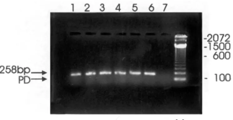 Fig. 1 -  Agarose gel electrophoresis of nested PCR-amplified HHV-6 DNA of 7 plasma samples/lymphocytes,  stained  with  ethidium  bromide and photographed under U.V light.