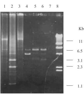 Fig. 2 - Agarose gel electrophoresis of plasmid DNA from F. nucleatum. Lane 1, strain D17 digested with EcoR I; lane 2, strain D17 digested with Hinc II; lane 3, strain D17 without endonuclease (Control); lane 4, strain D1 digested with EcoR I; lane 5, str