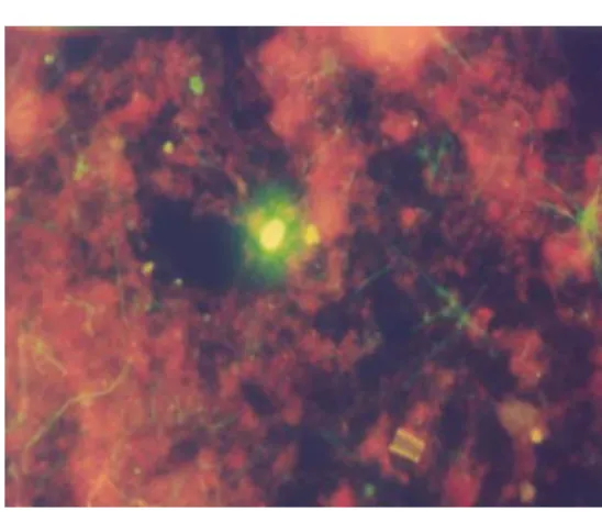 Fig. 1 - Giardia cyst, stained with kit 1 reagents, present in activated sludge samples of Santa Rosa ETE, Campinas, Southeast Brazil