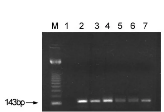 Fig. 1 - Agarose gel electrophoresis of nested PCR- amplified HHV-7 DNA of 7 serum samples, stained with ethidium bromide and photographed under U.V light
