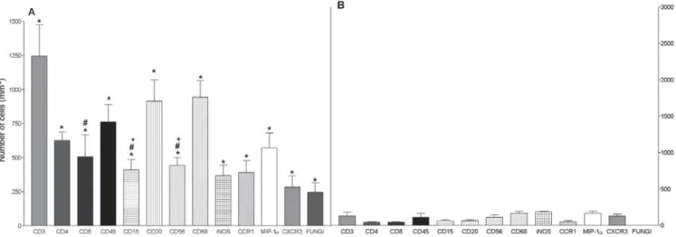 Fig. 1 - Immunohistochemical staining of (A) CD3 (x400), (B) CD4 (x200), (C) CD8 (x200), (D) CD45RO (x200), (E) CD20 (x200), (F) CD56 (x200), (G) CD15 (x200), (H) CD68 (x200), (I) S100 (x200), (J) CCR1 (x200), (K) CXCR3 (x400), (L) MIP-1a (x400), (M) iNOS 