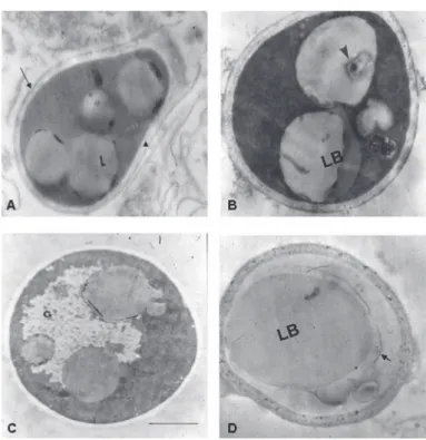 Fig. 3 - Ultrastructural changes on conidia exposed to lysozyme by transmission electron microscopy
