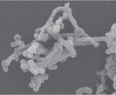 Fig. 3 - Scanning electron micrograph showing detail of coccobacillary to filamentous aspect of Nocardia asteroides type IV strain isolated from bovine mastitis