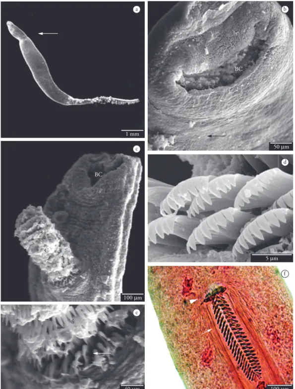 Figure 1. Gotocotyla acanthura. a) SEM (full view) showing the body constriction (arrow)