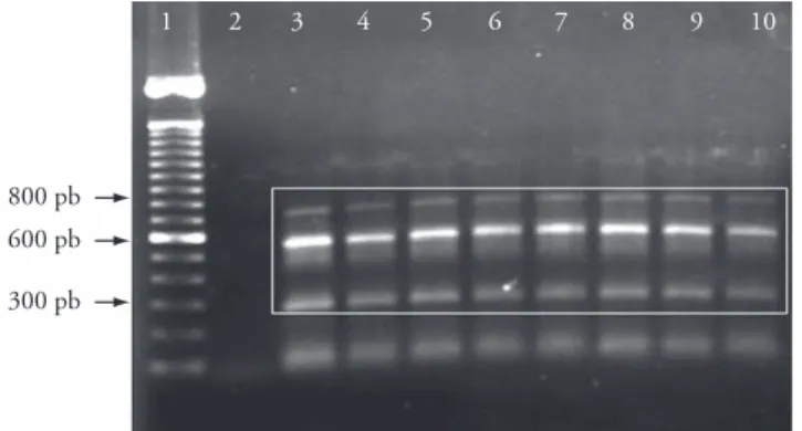 Figure 1. PCR electrophoresis patterns. Electrophoretic pattern  of PCR products obtained from L