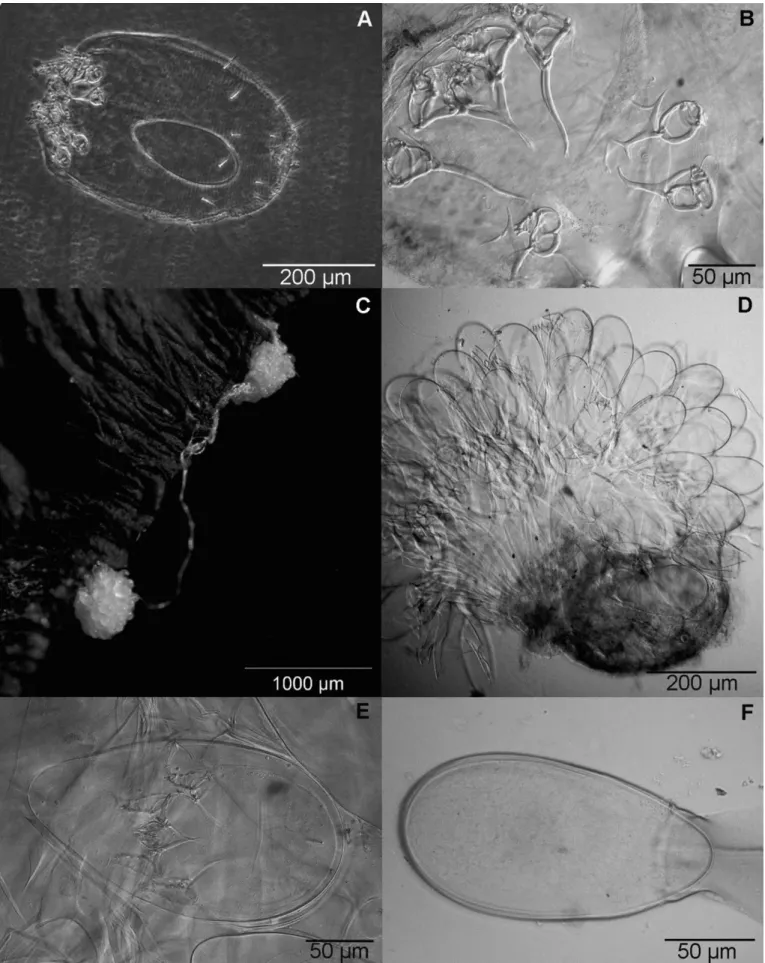 Figure 1.  Chirnyssoides amazonae. A, B, D, E, F Photomicrography with Differential Interference Contrast and D with microscope  esteroscopic