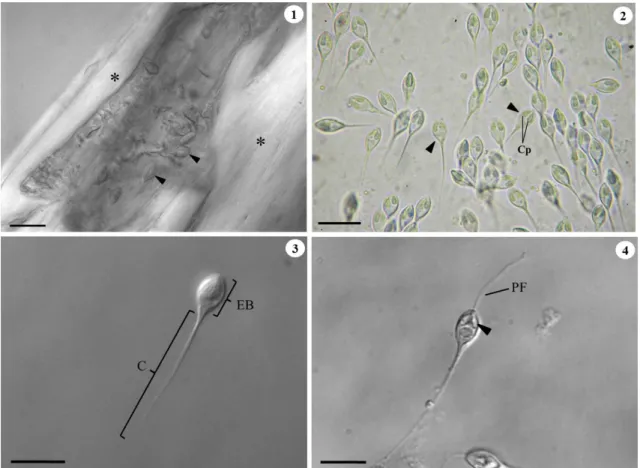 Figure 1-4. Optical micrographs of Henneguya sp. cyst and spores parasitizing H. marginatus