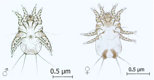 Figure 4. Strelkoviacarus critesi males and females (400X magnification).