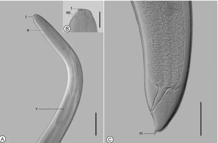 Figure 1. Anisakis sp. (L3) from Plagioscion squamosissimus observed by differential interference contrast, in lateral view