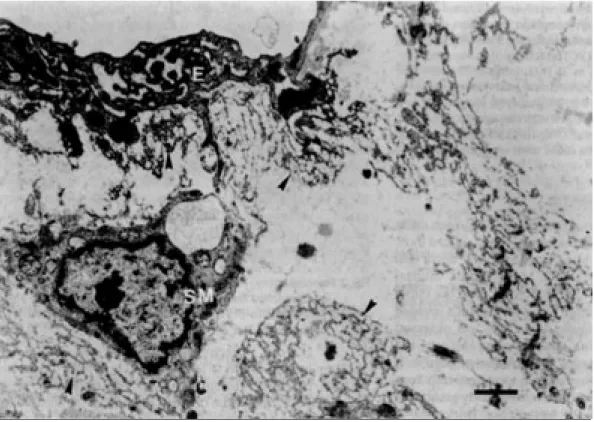 Fig. 4. Electron micrograph. Carotid artery.  Ty-pical modified SMCs of the synthetic type
