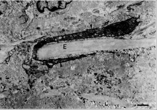 Fig. 6. Electron micrograph. Carotid artery. A modified SMC  (arrow-head) migrate from the media (M) to the  inti-ma (I) through a gap in the Internal Elastic Lamina (IEL) (E)