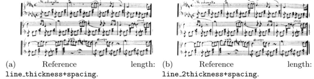 Fig. 2. Result of binarizing an example of a music score with the adaptive method.
