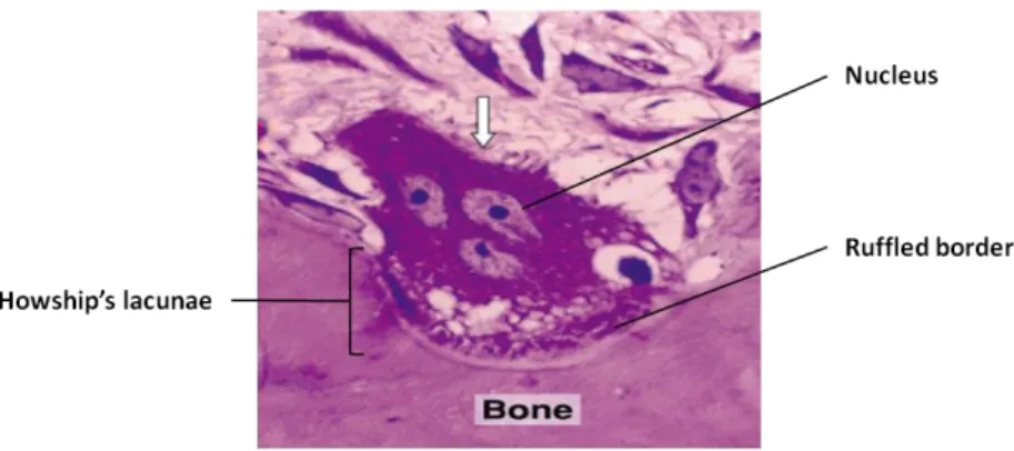Figure  3.  Image  showing  an  osteoclast  digesting  bone  tissue.  Osteoclasts  with  multiple  nuclei  and  a  ruffled  border  in  direct  contact  with  the  bone  matrix