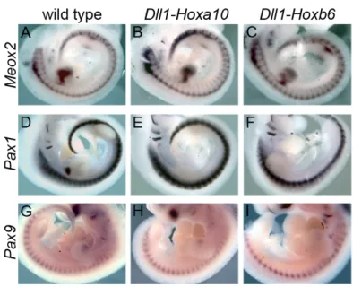 Figure 9: Normal sclerotomal patterning in Hox transgenics. Unchanged expression pattern  of several sclerotomal markers in Dll1-Hoxa10 and Dll1-Hoxb6 transgenics
