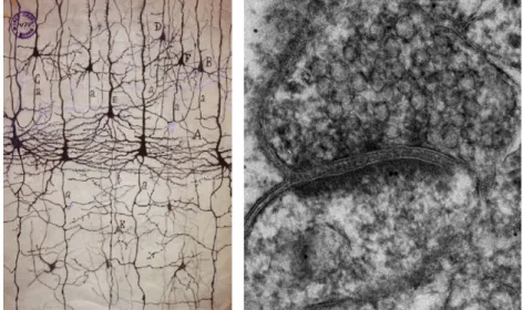 Figure 1. Neuronal synapses are specialized adhesion junctions (Left)  Ramon y Cajal drawing based on Golgi staining of neurons in cortical sections  of human brain (Right) High resolution EM picture of a dendritic spine 