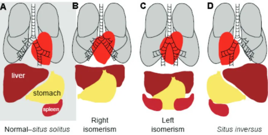 figure 1.4. Internal organ asymmetric organization. (A) Normal distribution of  the internal organs referred to as situs solitus