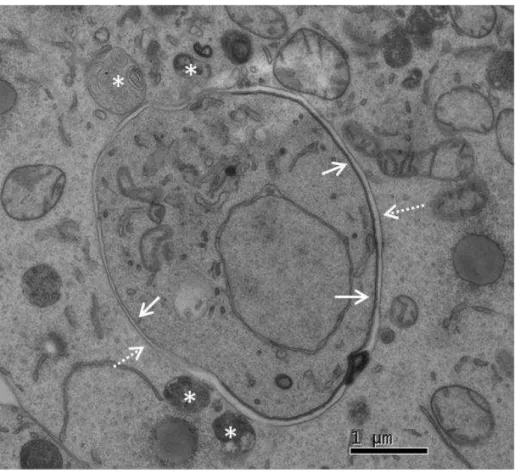 Figure  2.5  ±   Transmission  Electron  Microscopy  image  of  a  P.berghei  parasite  24  hours post infection suggests possible parasite-host vesicle interactions 