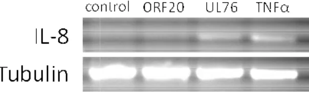 Figure 2.1.  UL76 induces IL transduced  with  control,  OR subjected  to  RT-PCR  using  p an internal control (bottom)