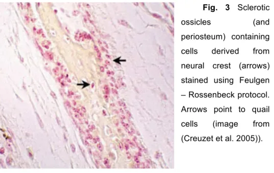 Fig.  3  Sclerotic 