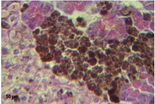 Figura  4  -Hepatopâncreas  de  tilápia  com  hemossiderose  e  degeneração  vacuolar hepática