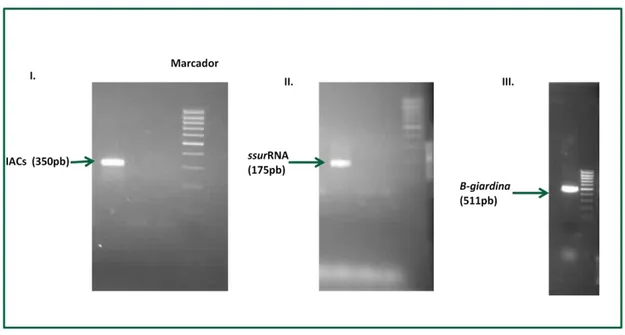 Figura 7. Fotografias de géis de agarose que demonstram as bandas obtidas para I. gene 18S humano  (350pb), II