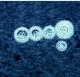 Figura 2.1. Células de Cryptococcus  neoformans em exame a fresco  de LCR de um doente com criptococose, corado com Tinta-da-China,  a  qual  põe  em  evidência  a  cápsula  (Fotografia  do  Laboratório  de  Micologia do IHMT)