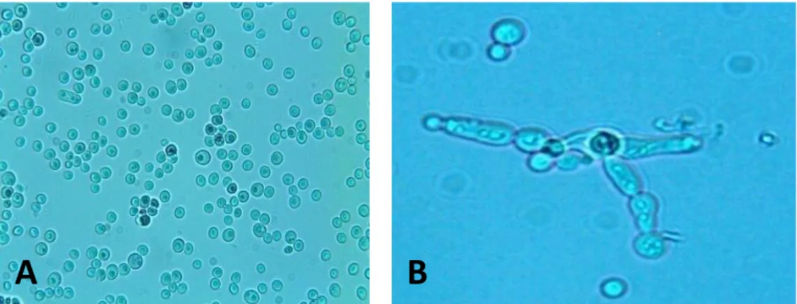 Figura 3.5: Observação microscópicadirectade exsudados vaginais.A- células leveduriformes  em gemulação, B - pseudohifas deCandida sp
