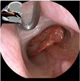 Figure 13: Nasopharynx of a brachycephalic dog with nasopharyngeal turbinates protruding on each  side of the vomer bone (Oechtering et al., 2008)