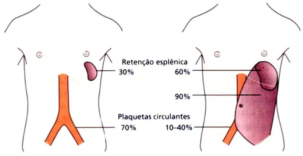 Figura  2  -    Distribuição  de  plaquetas  entre  a  circulação  e  o  baço  em  indivíduos  normais  (esquerda) e pacientes com esplenomegalia moderada e maçica Fonte: HOFFBRAND,2013    