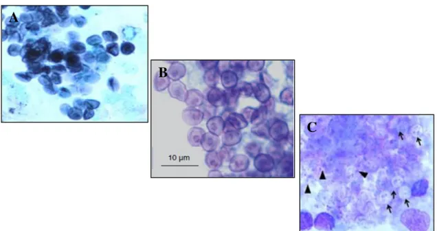 Figura 6. Detecção microscópica de formas morfológicas de Pneumocystis em LBA: A: Visualização de  quistos  corados  com  GMS  (ampliação  500X);  B:  Visualização  de  quistos  corados  com  TBO; 