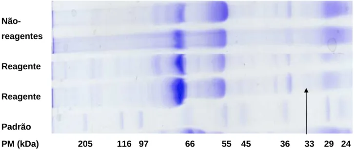Figura 8 - Traçados densitométricos em SDS-PAGE de amostras de cães não-reagentes e de cães  reagentes à RIFI para LVC, bem como traçado padrão com os respectivos pesos moleculares  (PM; kDa)