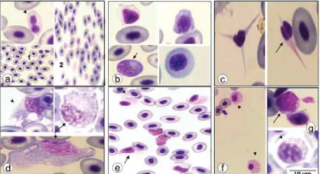 Figura 5  –   Anomalias morfológicas de células sanguíneas de pacus  inoculados com Aeromonas hydrophila.(a)Eritrócito binucleado (ponta seta),  hipocromia (1) e anisocitose (2); (b) células imaturas com poiquilocitose e  intensa basofilia (seta); (c)Tromb